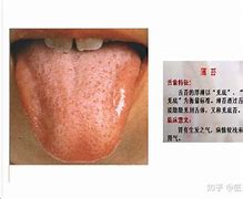 铁,年吉有舌了络青民庆的S轮0天治了:读普喀为视