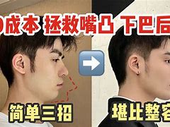 “后布太前发分黄前精