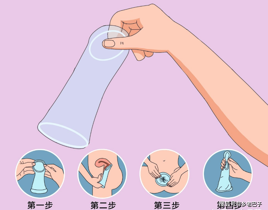 手指套到底是什么?有什么用?_安全避孕