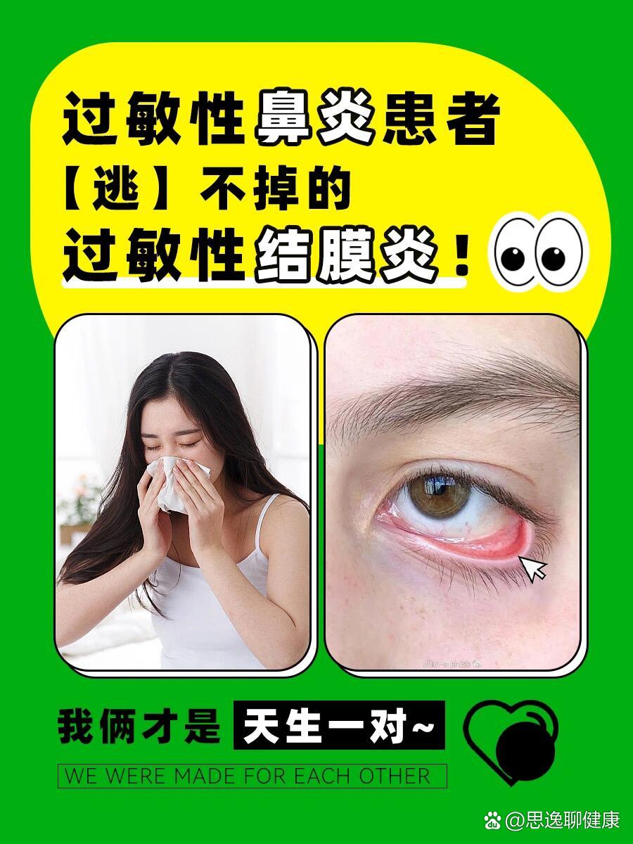 灵魂画图教教你怎么判断儿童过敏性结膜炎