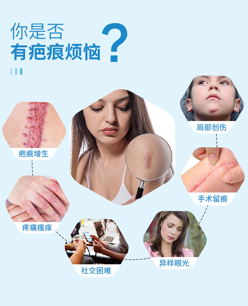 芭克到底有没有生物作用?_祛疤产品