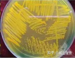 溶藻弧菌ELISA测定,弧菌免疫特性检测,第三方检测机构