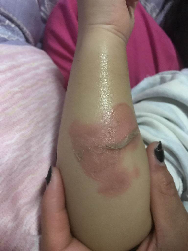 鹅卵石含甲醛吗我家里放了很多,对小孩子有影响吗