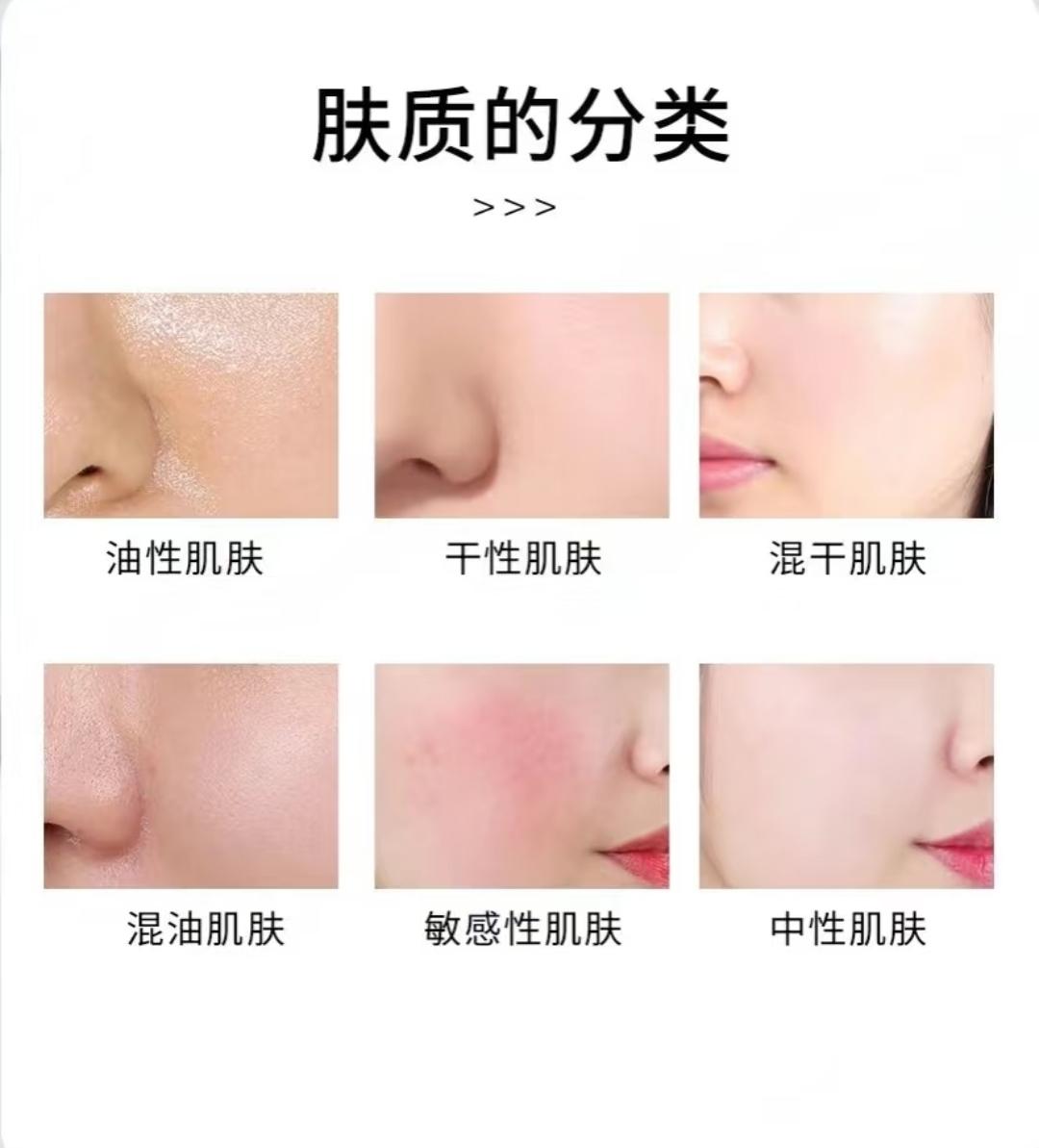 皮肤肤质有几种