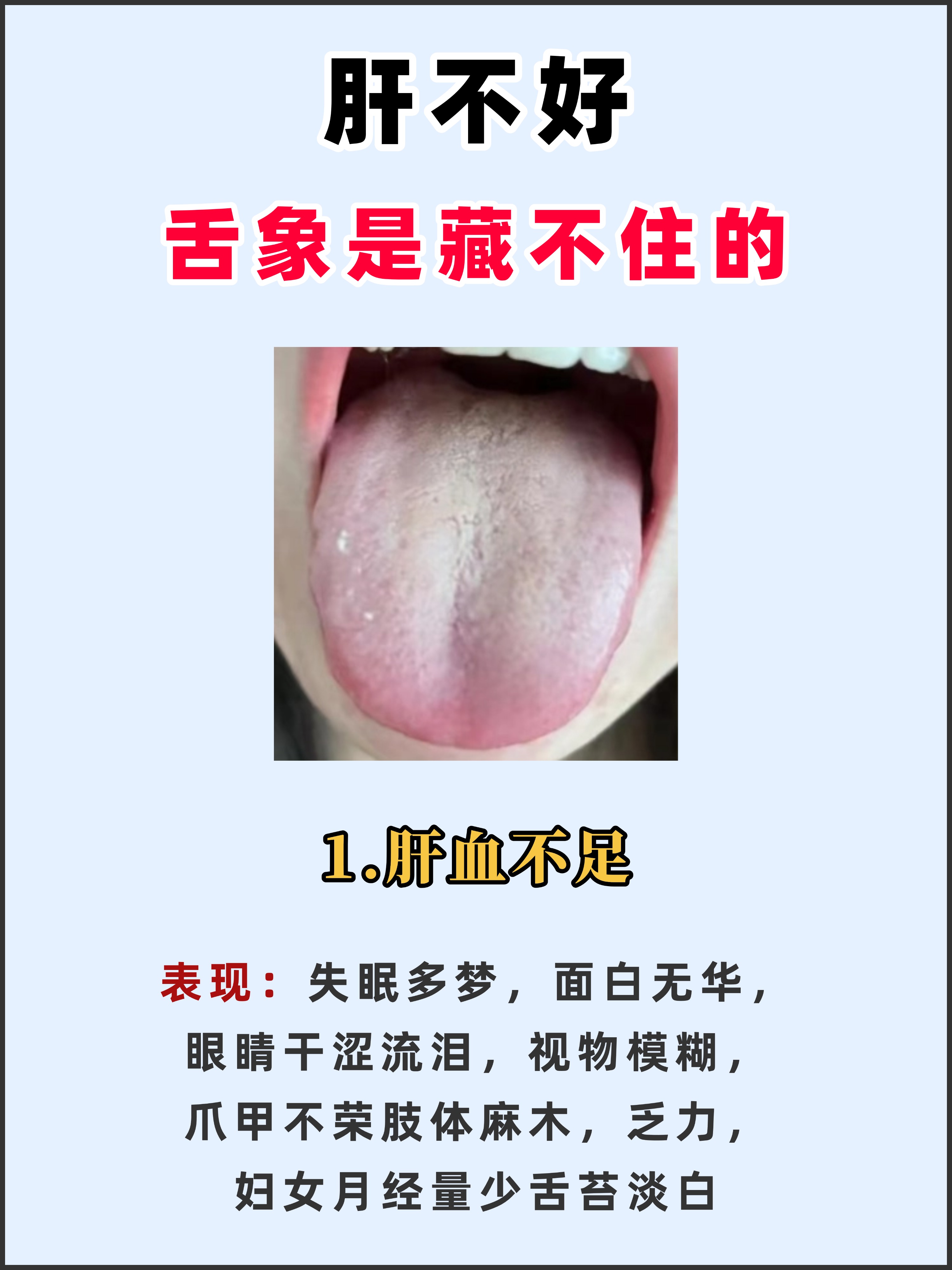 肝肠寸断是什么意思解释