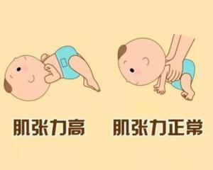 肌张力是什么病怎么治?