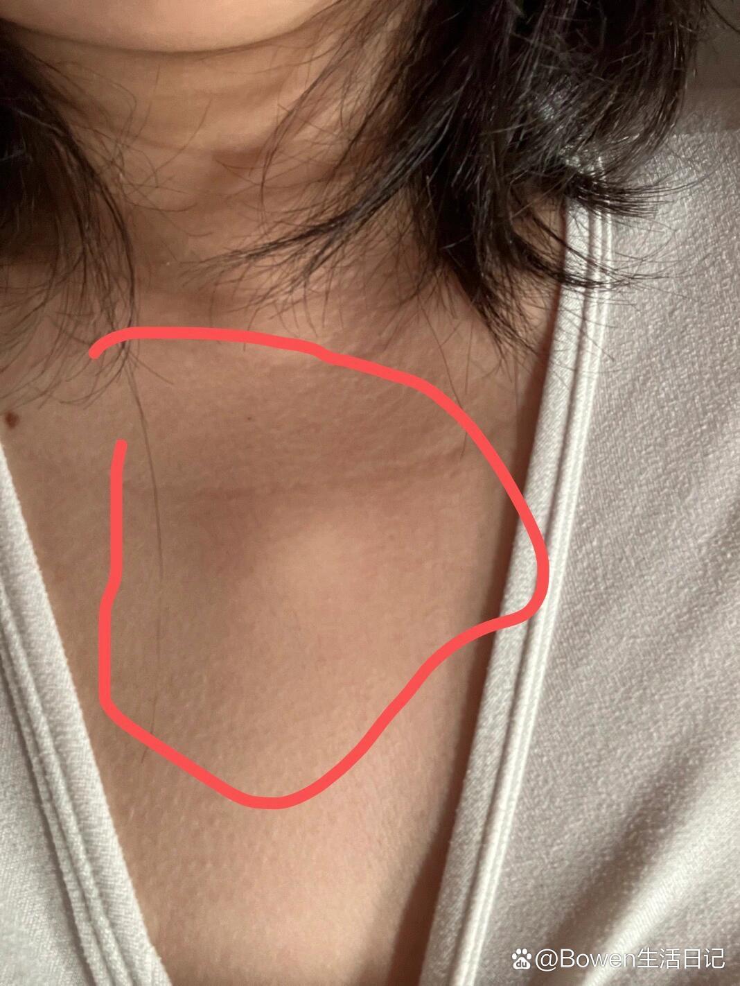 锁骨中间有胎记的女人命运