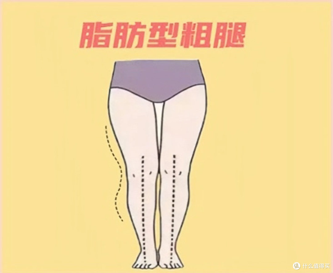 如何判断水肿腿还是变胖了