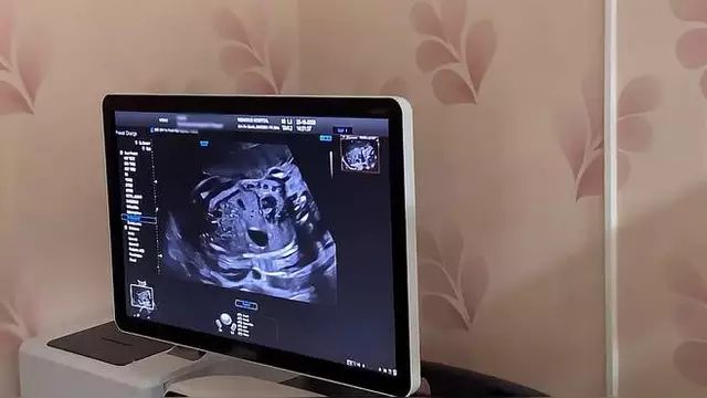 如何从b超单看出男女