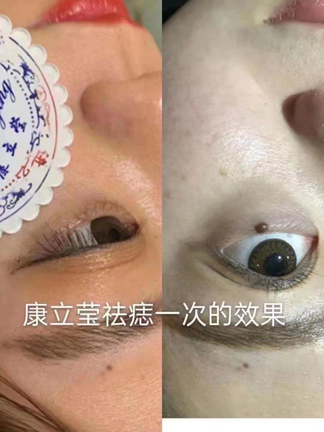 泪痣的人命运怎样