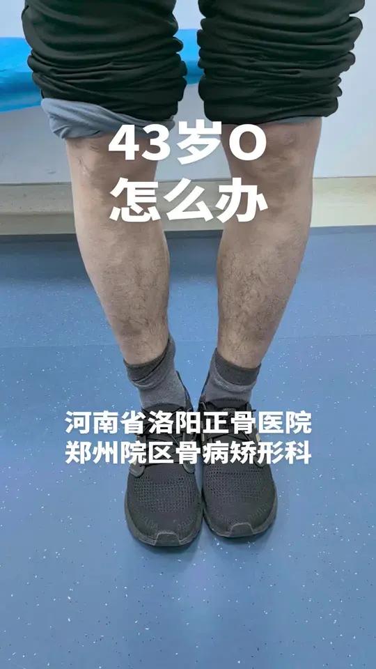 o型腿手术成熟吗