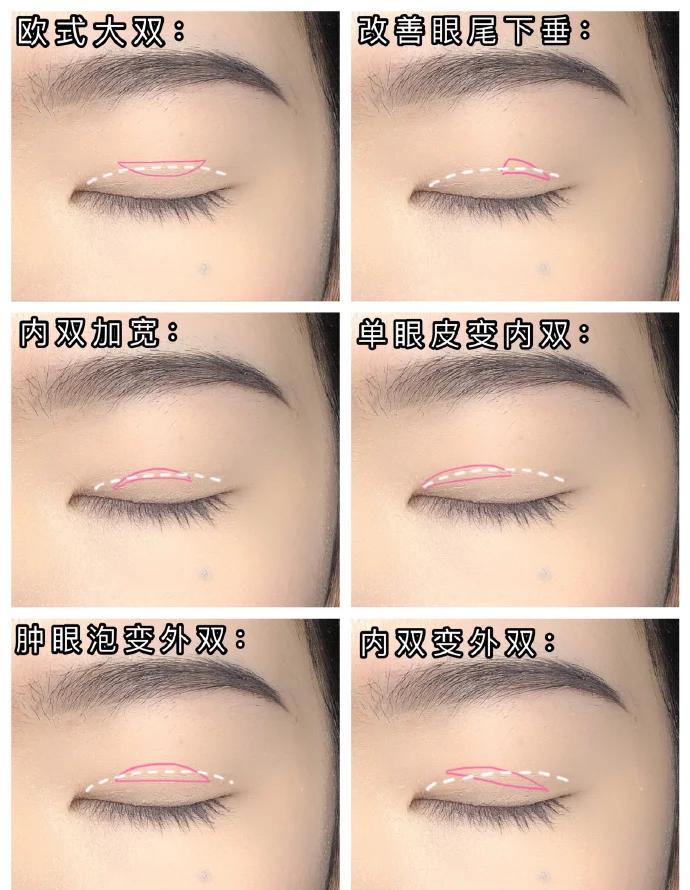 蕾丝双眼皮贴怎么贴