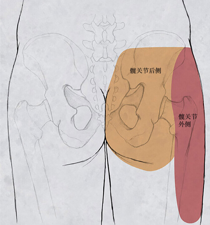 屁股髋关节在哪个部位