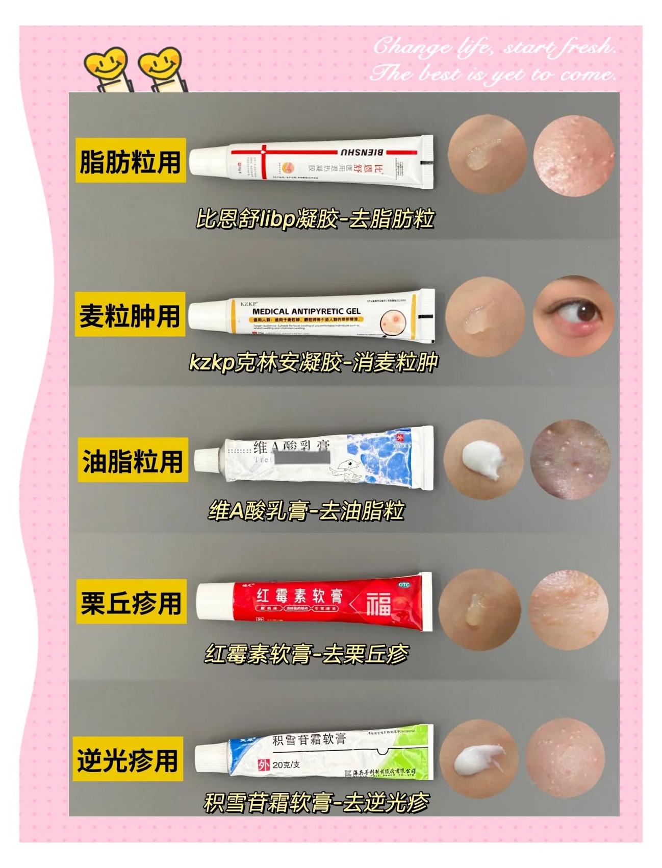 脂肪粒怎么去除小窍门金霉素