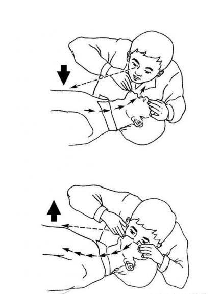 人工呼吸四种方法