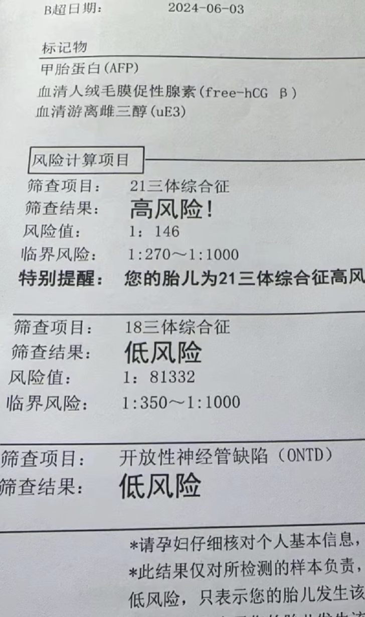 什么是唐宝宝?为什么都长的一样?
