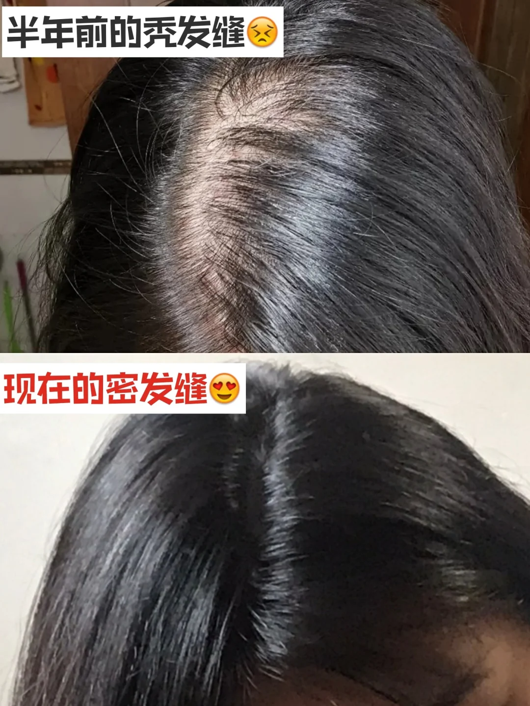 梦到自己秃顶意味着什么
