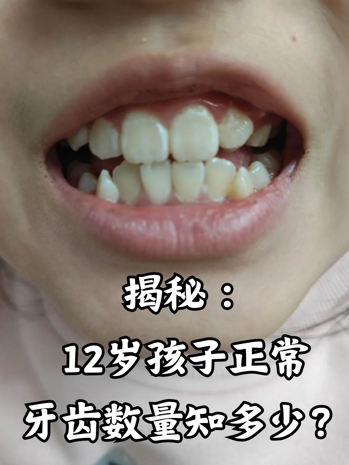 一般成人有多少颗牙齿