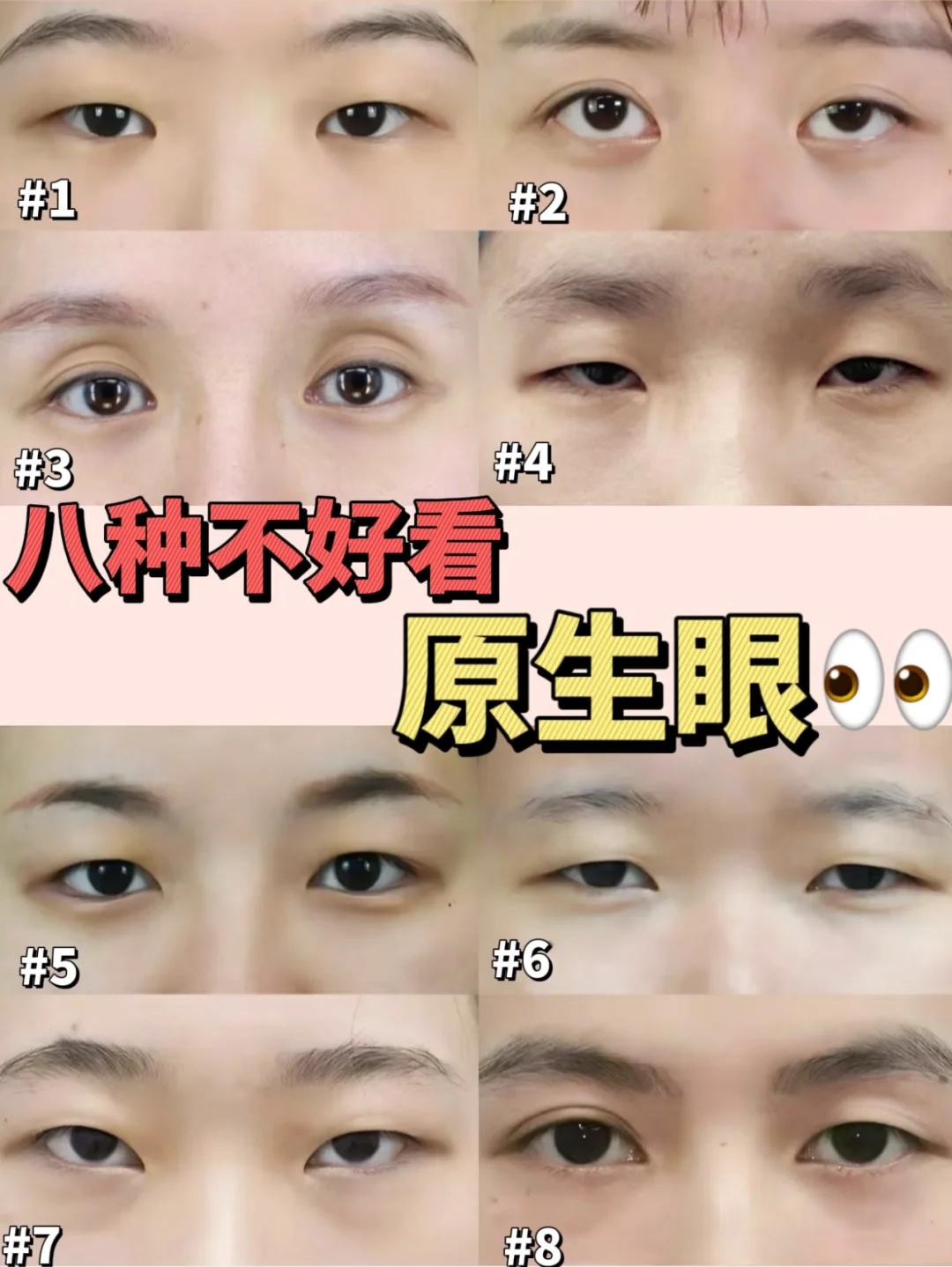 眼睛的全部类型