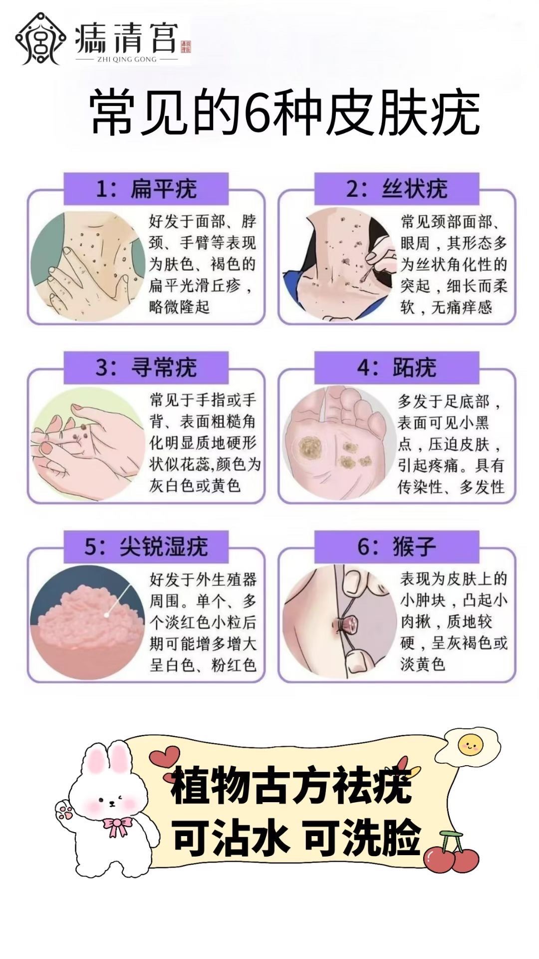 蜘蛛痣怎么形成的