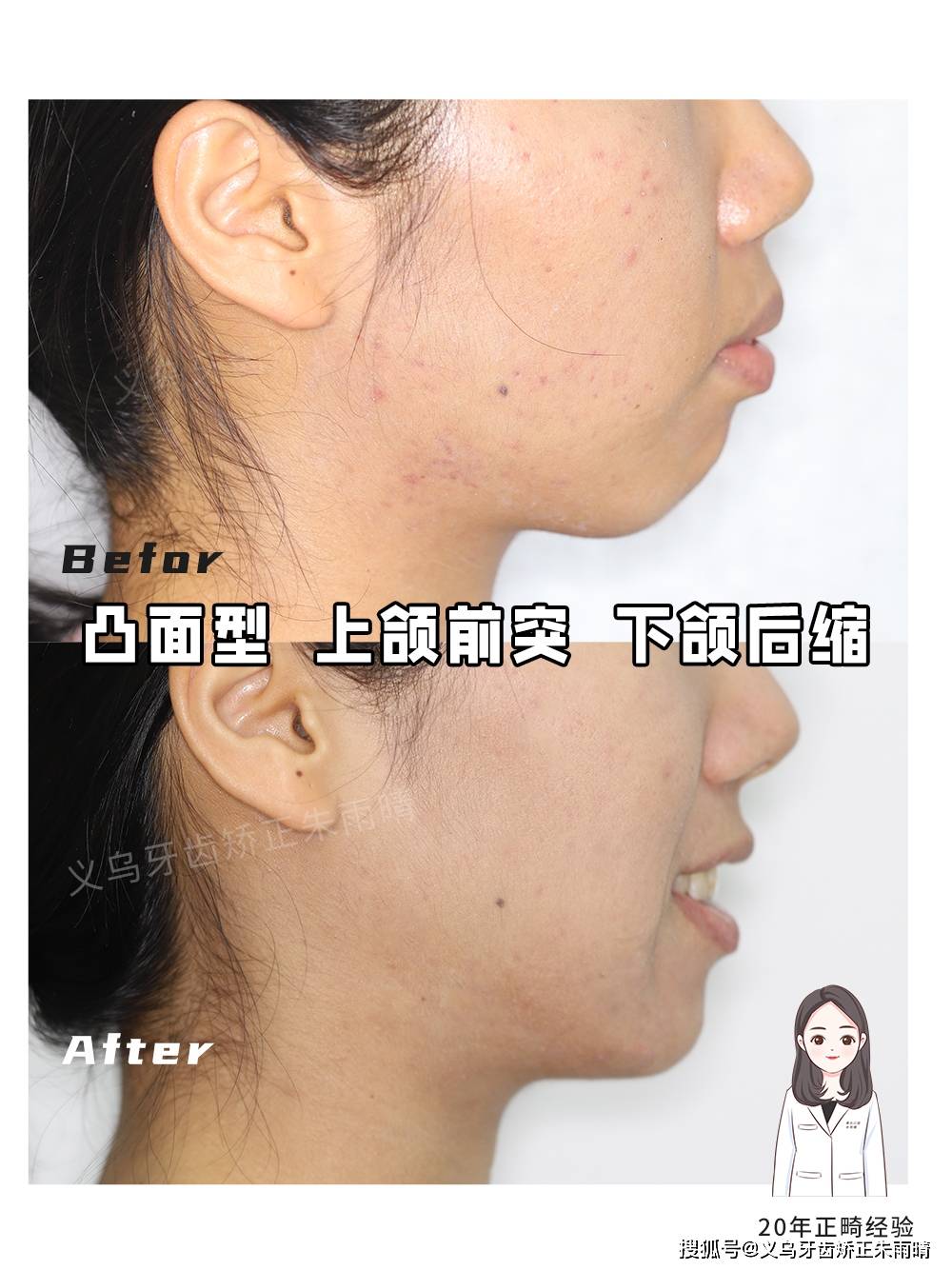 20岁头型扁不好看怎么改善