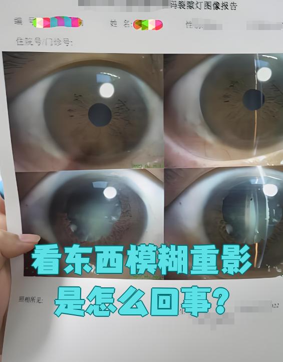 今天看东西模糊