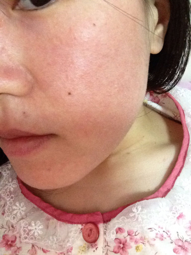 角质层厚重是什么样子的