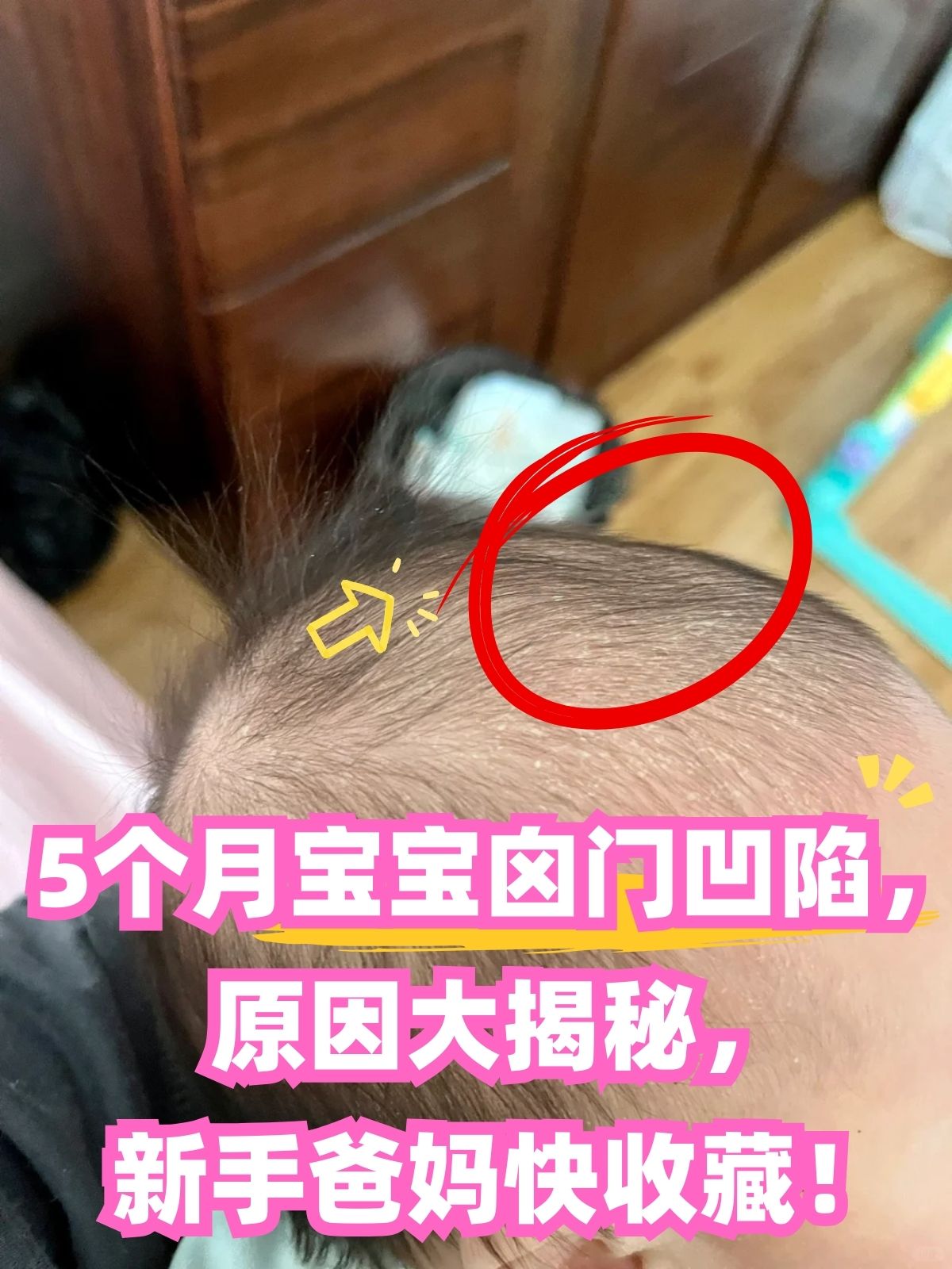 儿童卤门大小标准