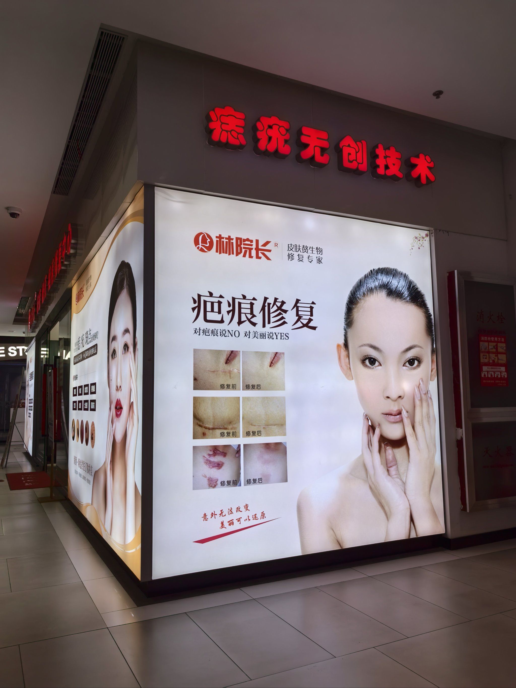 取痣后多久恢复好