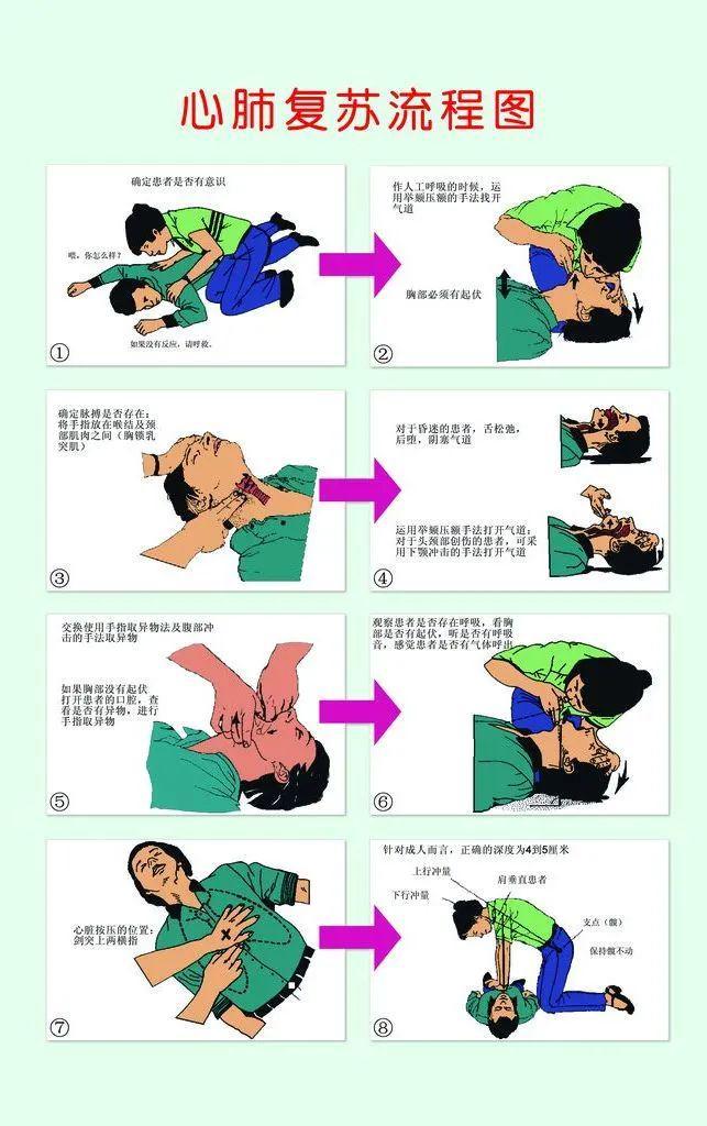 什么是心肺复苏