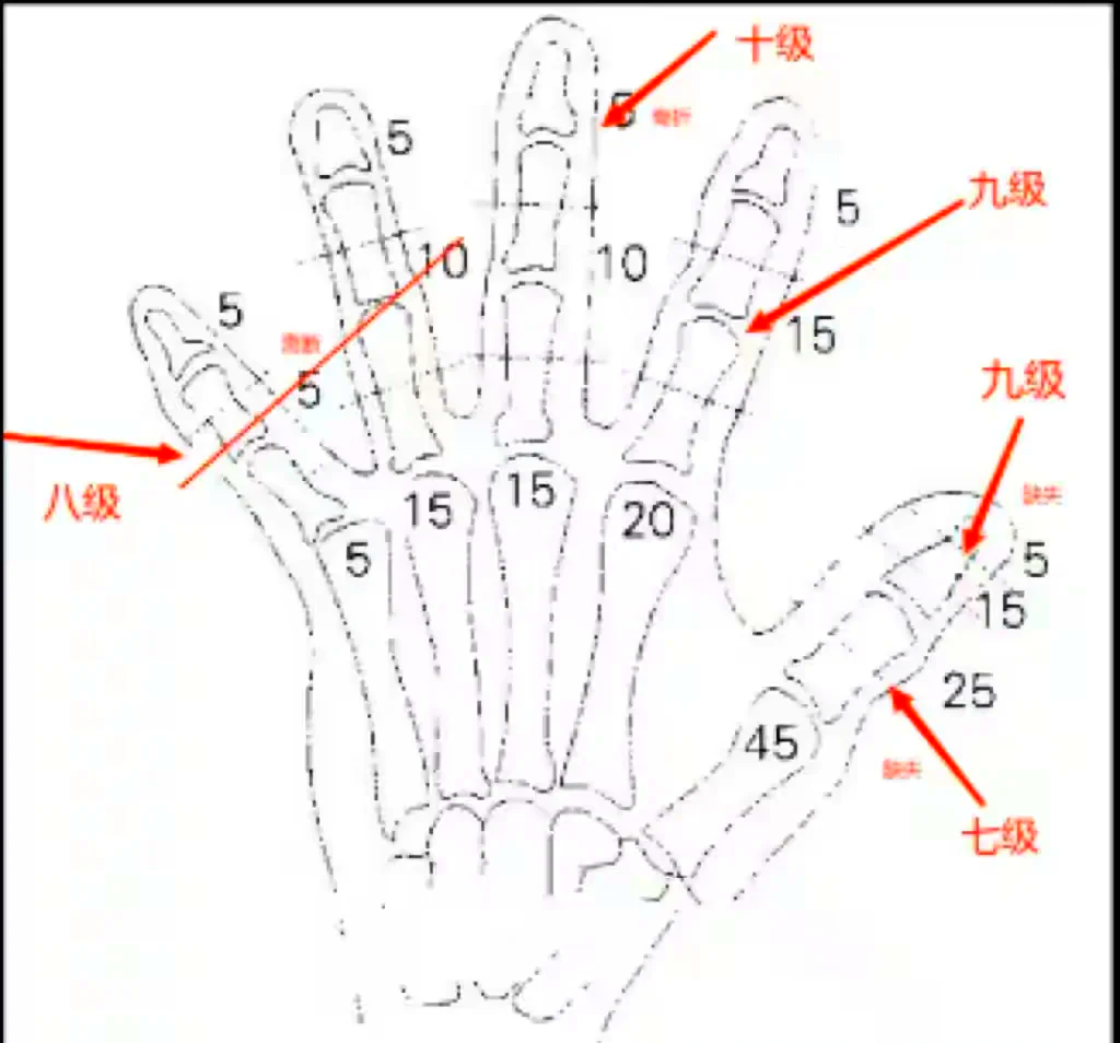 五根手指医学术语