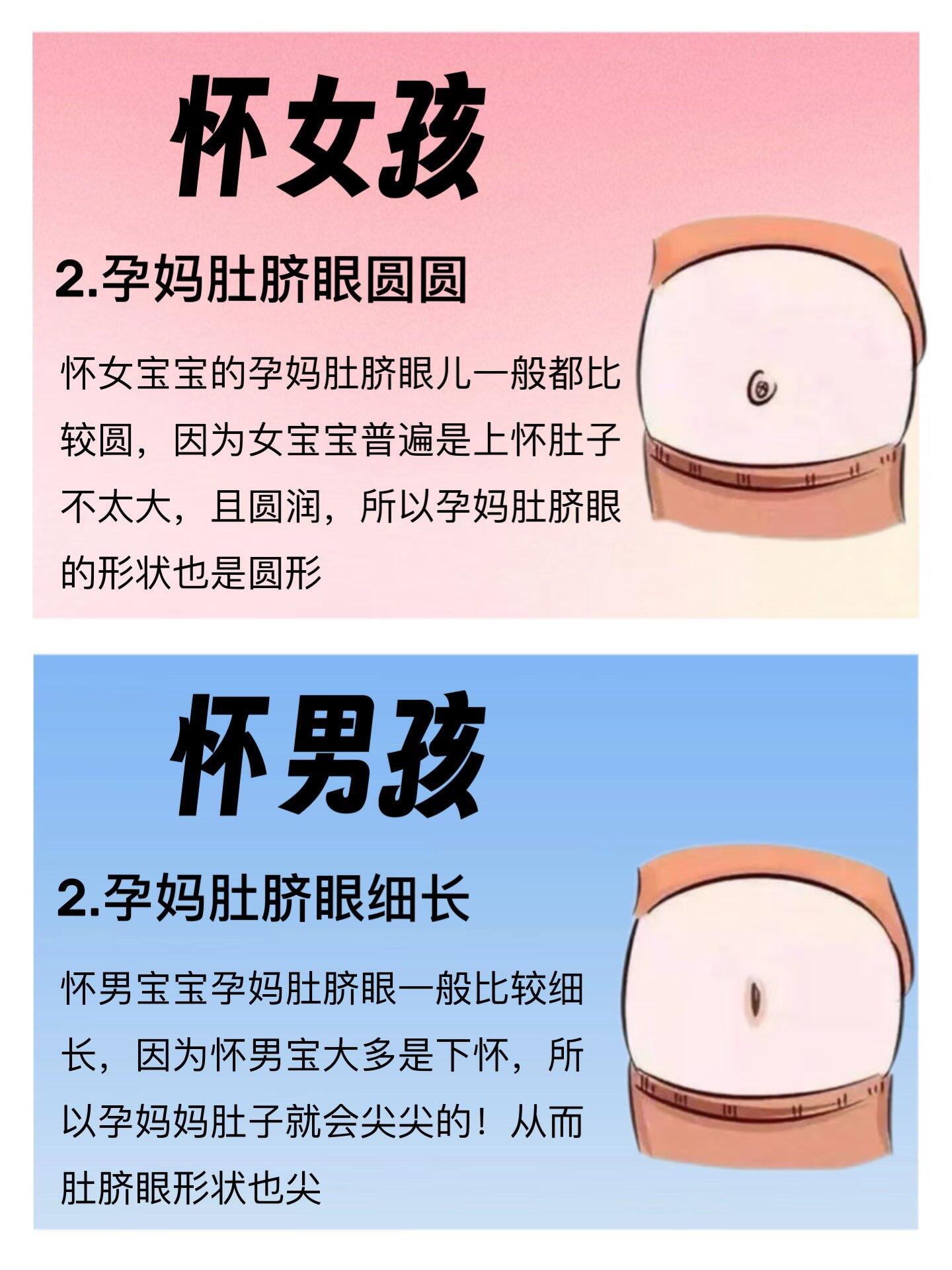 如何从妊娠线看男女