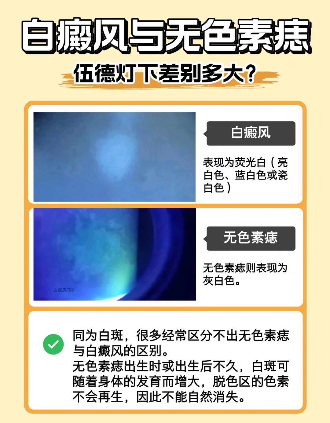 白炽灯用久了会发黑是因为啥