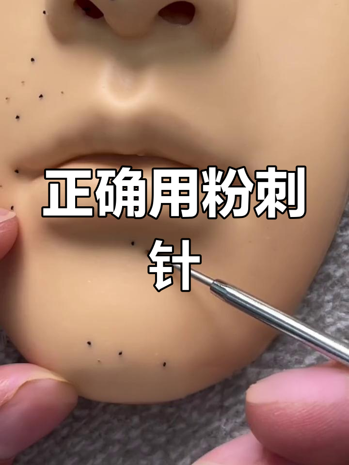 粉刺针如何使用去黑头