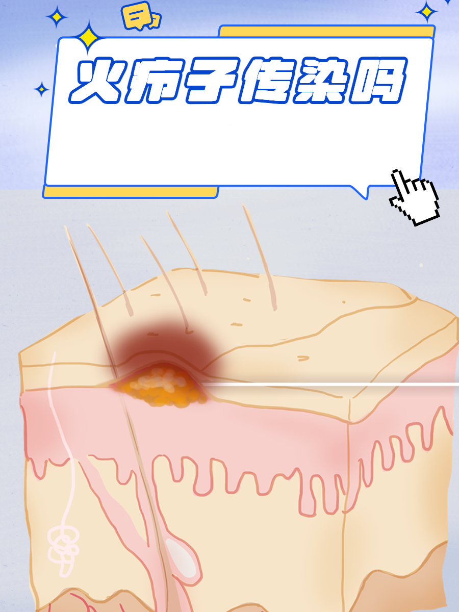 疖子怎么读拼音