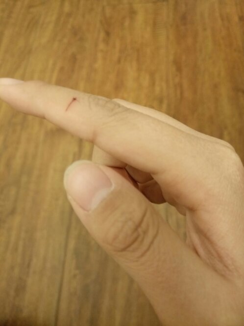 女人梦见狗咬手是什么