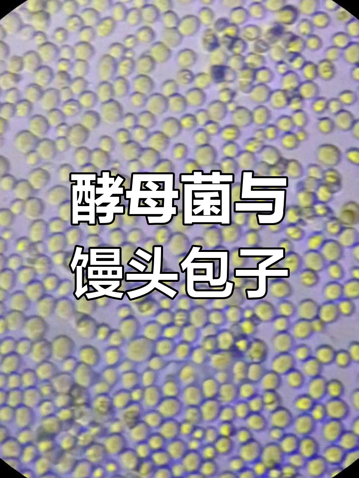 酵母菌是真核还是原核