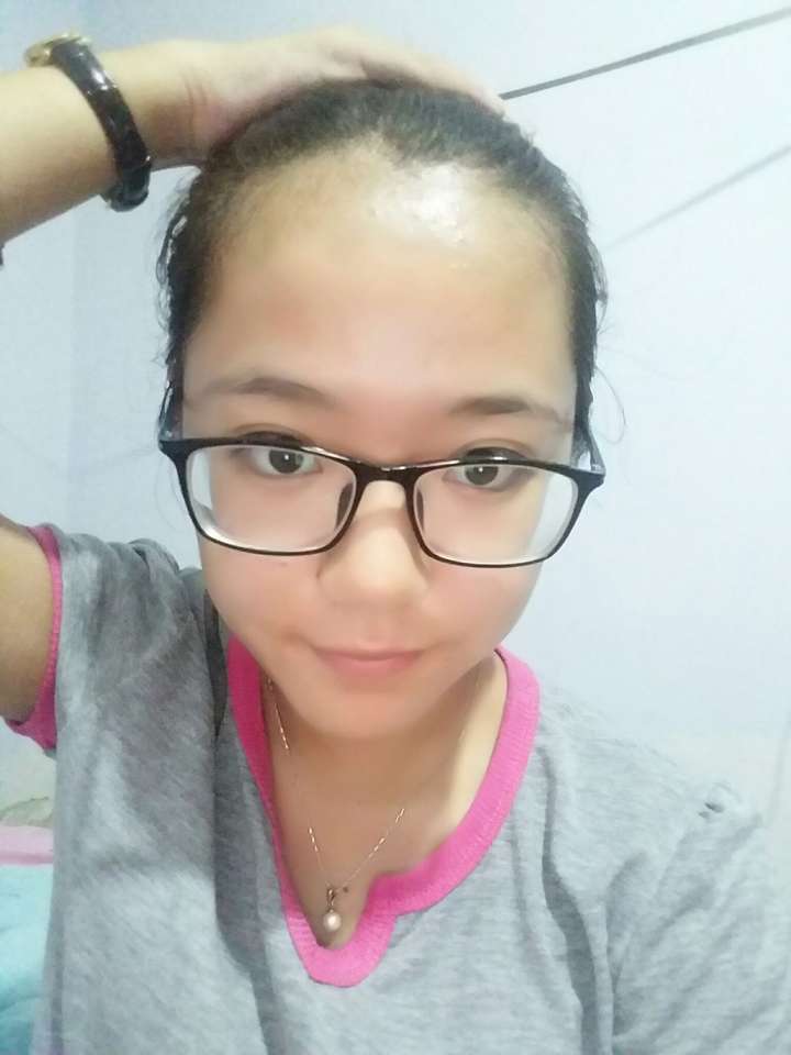 额头高适合什么发型显脸小