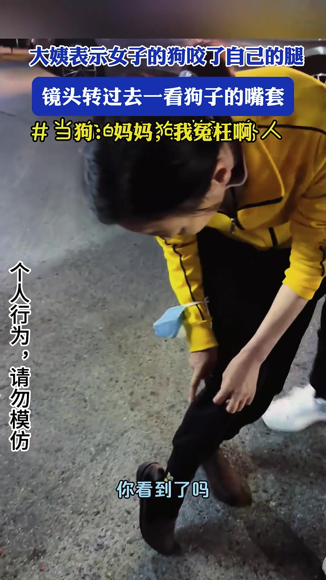 梦到狗咬我腿没出血