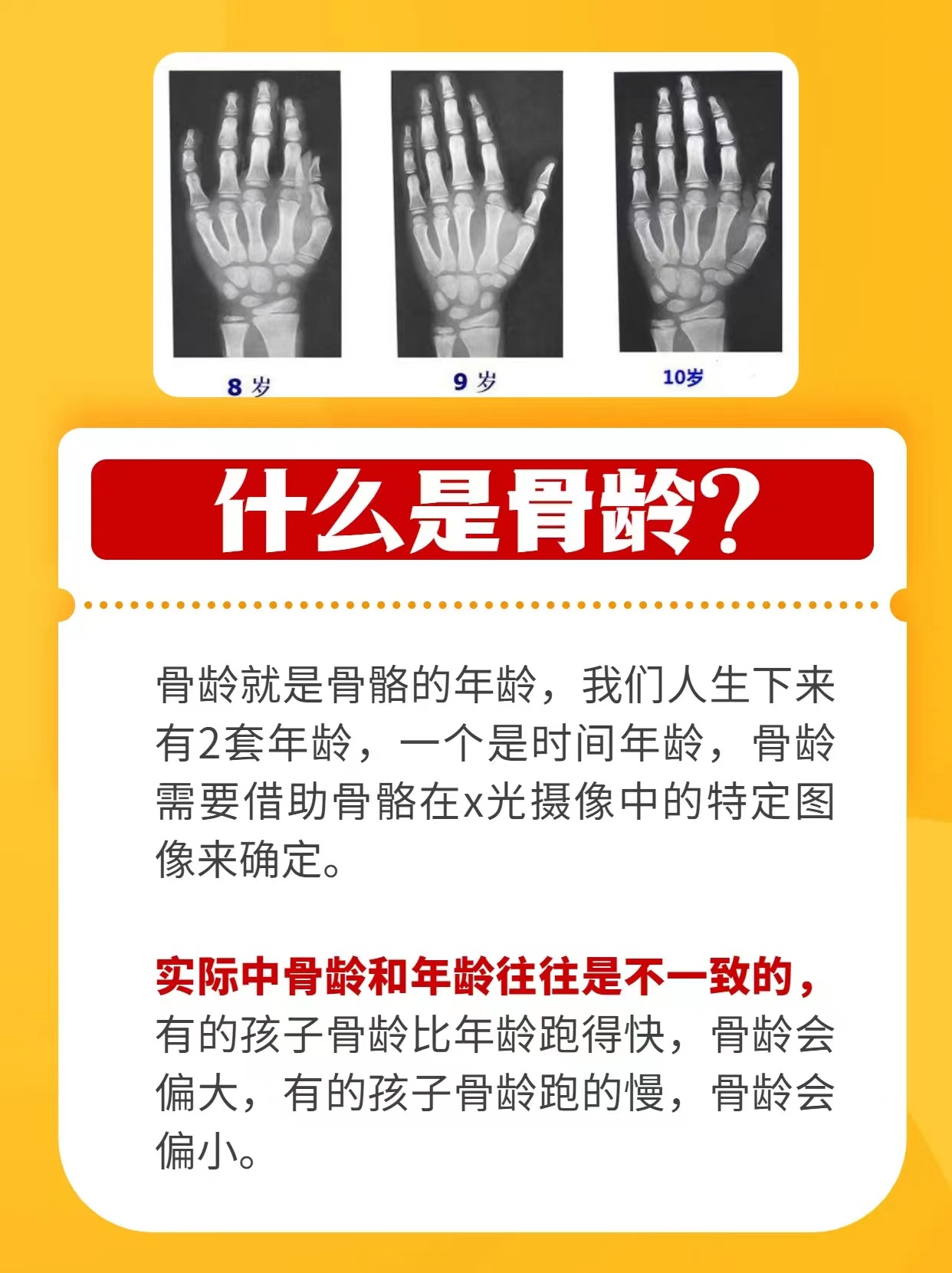 怎么测自己骨龄