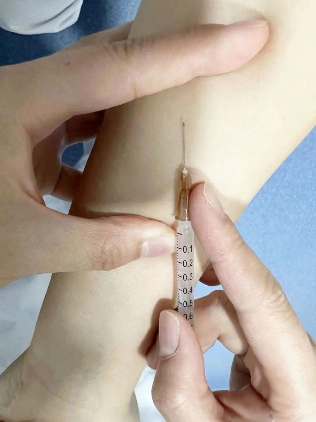 ppd是什么检查结果